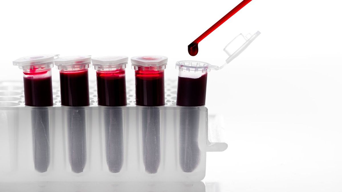 Vědci poprvé podali lidem transfuzi krve, která byla vypěstovaná v laboratoři
